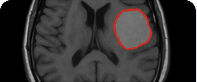 Brain Tumor Dataset: Segmentation &…